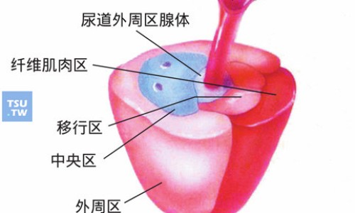 腰椎PVP手术术后护理-腰椎PKP手术后戴护具走路要注意什么,中国腰椎pkp术后用药原则网站